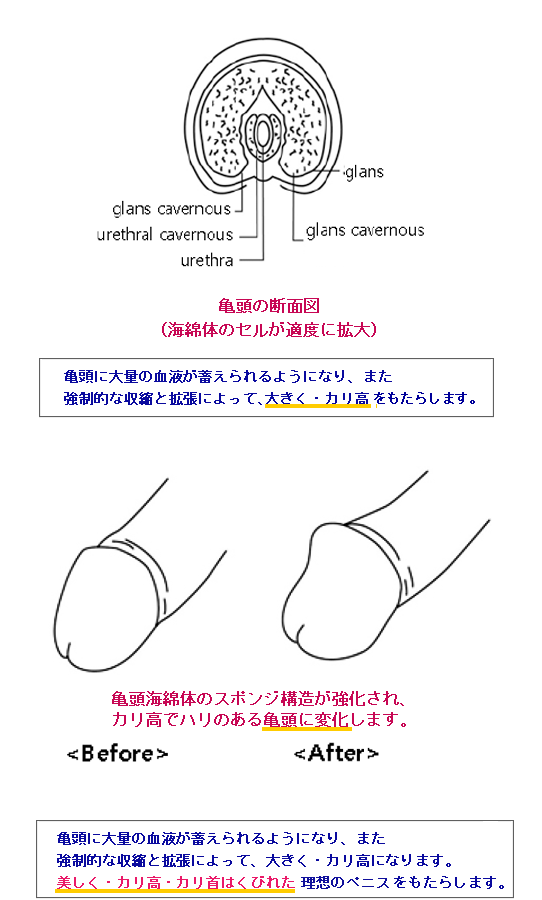 �~�X�^�[�n�C�T���f�ʐ}